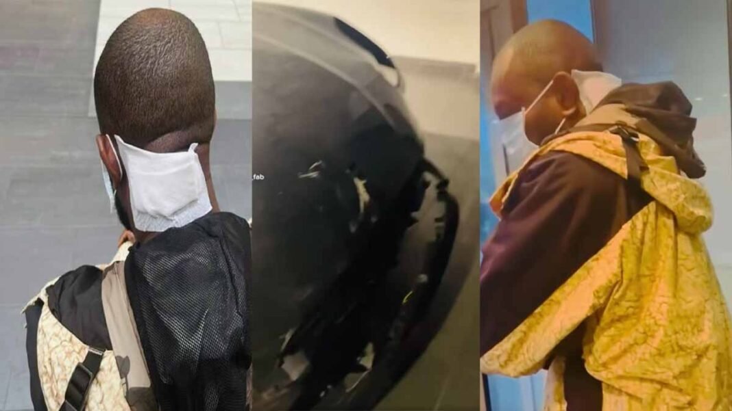 (VIDEO) Urgent Fabregas le Metis Noir victime d’un accident de voiture